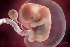 太原借卵试管婴儿的案例,结果是多囊卵巢综合症