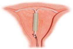 有没有女人愿意代孕_泰国吞武里试管生殖中心的