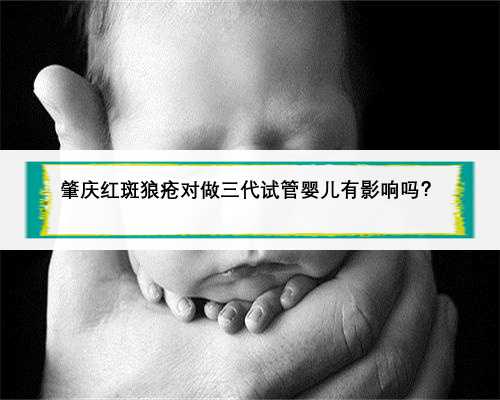 肇庆红斑狼疮对做三代试管婴儿有影响吗？
